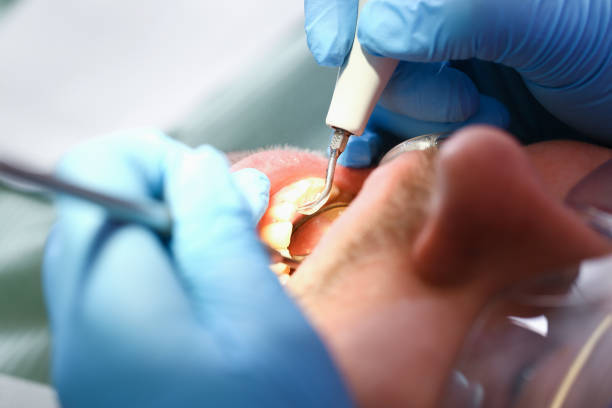 Best Cosmetic Emergency Dentistry in Upper Saddle River, NJ