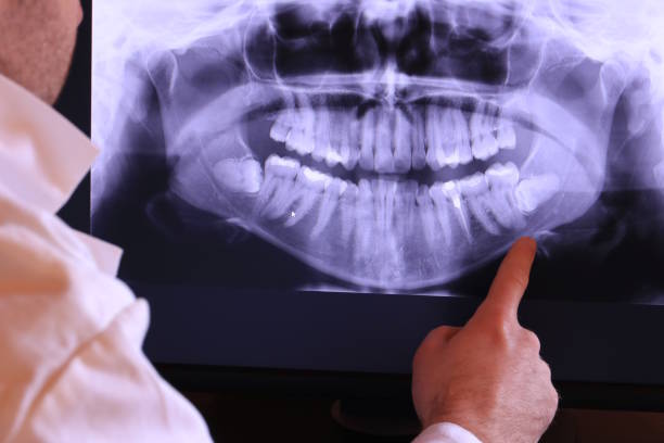 Best Same-Day Emergency Dental Services in Upper Saddle River, NJ