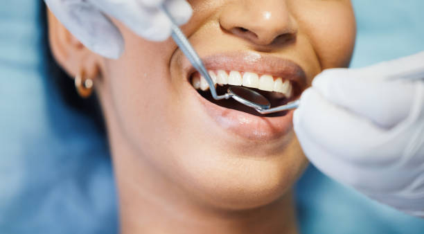 Best Urgent Care for Lost Fillings or Crowns in Upper Saddle River, NJ