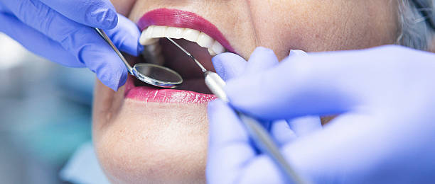 Best Emergency Treatment for Dental Infections or Abscesses in Upper Saddle River, NJ